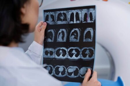 X-Ray Scan